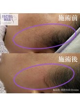 デニム(Denim)/範囲が難しいもみあげ部分も、