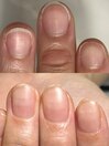 お客様Beforeafter