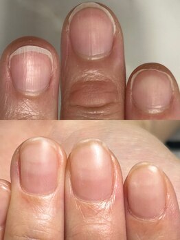 ハッチネイル(HACCI nail)/お客様Beforeafter