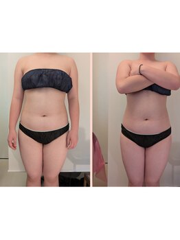 ワイズ(Y's)/お腹８回目