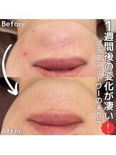 ベルファーム(Belle Femme)/プラズマシャワー☆