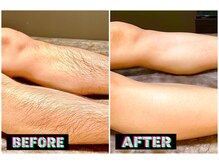 メンズスリーナインサロン(Men's ThreeNines Salon)/脚BA