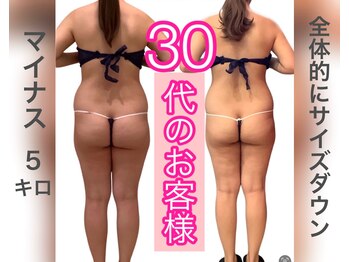 アールズ スリム(R's slim)/痩身ダイエット専門店の結果出し