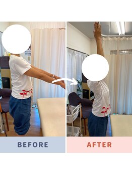 坂口カイロプラクティック整体院/ビフォー・アフター