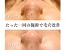 ハイドラ毛穴洗浄+美容液導入＋スチームLEDライト付♪［50分］¥8000