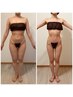 【安佐南区ダイエット人気No.1】全身集中本気ダイエット初回9900円