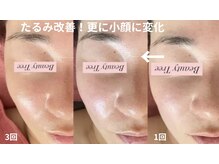 ビューティーツリー(Beauty Tree)の雰囲気(温活も充実!ポカポカ・毛細血管を活発にして美肌と健康をGet♪)