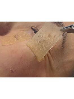 シミしわ改善！予防ケア