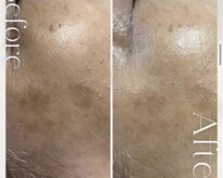 サンサンサロン 淀屋橋店(33salon)