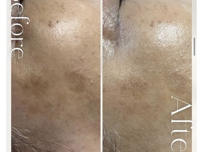 サンサンサロン 淀屋橋店(33salon)の写真