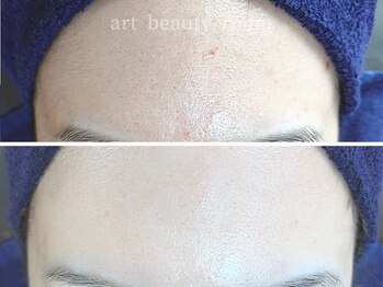 アート ビューティールーム(art beauty room)/☆XE'LHA PEEL （セラピール） 