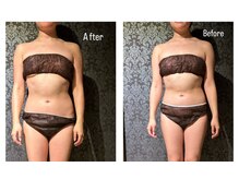 キャッツ ビューティデザイニング(cats.beauty designing)/【施術写真ビフォー・アフター】