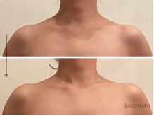 サロン タエン/首が長く見える！インディバ小顔