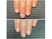ルカロンネイル(Rukaron Nail)/ちび爪・丸爪
