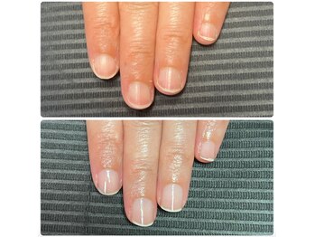 ルカロンネイル(Rukaron Nail)/ちび爪・丸爪