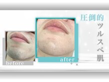 髭ラボ(髭LABO)の雰囲気（《美容男子から注目☆》美肌も叶うヒゲ脱毛♪）