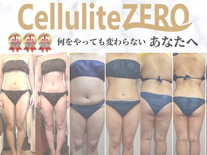 ラクワン(R coin)の写真