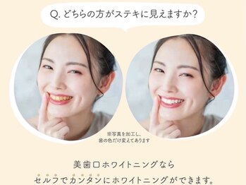 ボディケアアップ(BODY CARE UP↑)/歯の着色汚れ気になる方