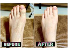 メンズスリーナインサロン(Men's ThreeNines Salon)/脚の甲・指