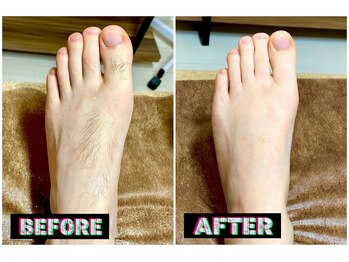 メンズスリーナインサロン(Men's ThreeNines Salon)/脚の甲・指