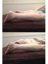 ロックスペーストーキョー(Rock Space Tokyo)/インディバ痩身/九段下/銀座