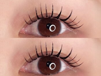 アリー(Ally)/バインドロック