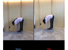 徳島藍住整骨院 ザ ビー(THE B)/ピラティス初回体験before/after