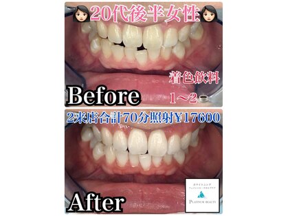 ホワイトニングビューティ 三川店の写真