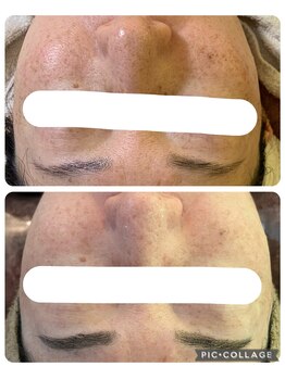 エクシア(ECXIA)/お肌も明るく