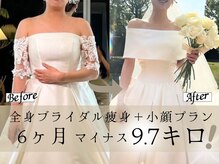 スリムプロの雰囲気（自分史上1番美しいを叶える☆ブライダルエステならスリムプロ）