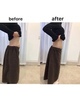 ジョワイユ(Joyeux)/腸の位置でお腹は変わる