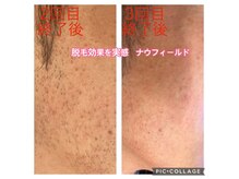 ナウフィールドの雰囲気（メンズ歓迎◎最新脱毛機！！抜けを実感☆ツルスベモテ肌に♪）