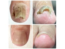 ゴレラ(gorella)の雰囲気（痛みで歩くのも困難だった巻き爪/初回の施術で痛みから解放！）