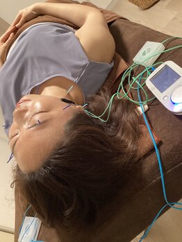 ハリファ鍼灸院 横浜関内院(HariFa鍼灸院)/美容施術/美容鍼