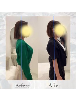 リルミ 天王寺院(ReLUMI)/【姿勢改善】巻き肩・猫背が整う