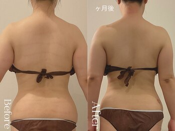 ユーフォリア グロウ(euphoria glow)/{ ラフォス痩身90分 8回 }