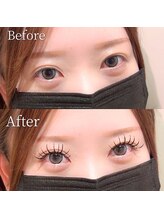 モナ(MoNa)/アンドヘルシー(&healthy)