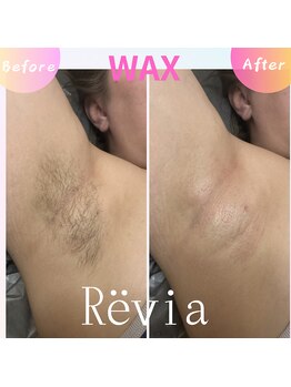 レビア(Revia)/自己処理は痒みや黒ずみの原因に