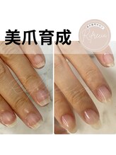 リフレシア(Rifrecia)/美爪育成