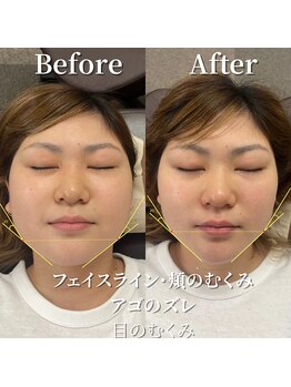 こうぞう整体院/美容鍼×筋膜リリース