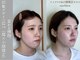 ナビレラ(navillera)の写真/【小顔矯正×アイブロウ】お顔のバランスを整えナチュラルに垢抜け♪小顔のプロがオーダーメイドでご提案◎
