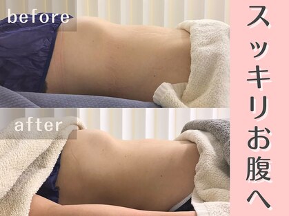 エイル 大橋(Eir.)の写真