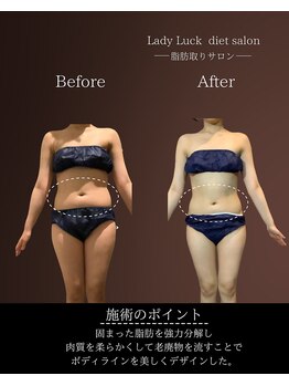 レディラック 大阪梅田本店(Lady Luck)/がっつりサイズダウンコース