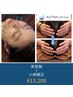 【全員】たるみ・むくみに｜美容鍼＋小顔矯正