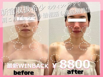 ビオール 新宿店(beall)の写真/顔の変化が目で見てわかる◎【最新機器ウィンバック×頭蓋骨矯正60分￥8800】