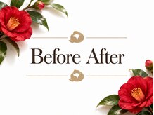 ツバキ 岐阜店(TSUBAKI)/施術/before→After