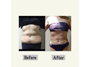 ペールノエル 富士店(PERENOEL)/EMスレンダー(50代女性)