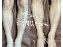 フェリーチャ(Felicha)/1回だけで２週間後も持続します