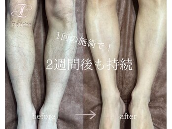 フェリーチャ(Felicha)/1回だけで２週間後も持続します