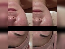 フェアリー 小松店/リラックス/オールハンド